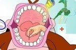 Sacar dientes Sacar dientes